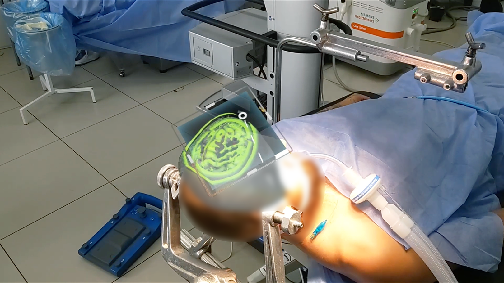 Extra Vision Optical Tracking Tool