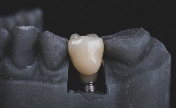 Dental