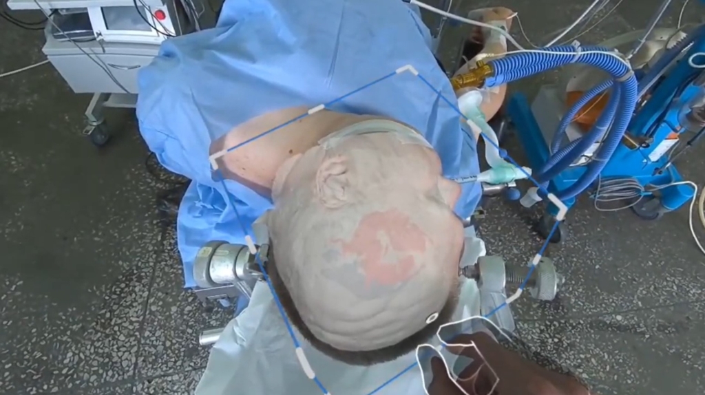 Augmented Reality AR solution for Surgical Intelligence
